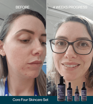 The Essential Core Four