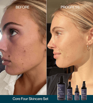 The Essential Core Four