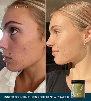 Skin + Gut Renew Duo