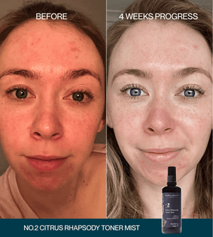 No.2 Citrus Rhapsody Toner Mist