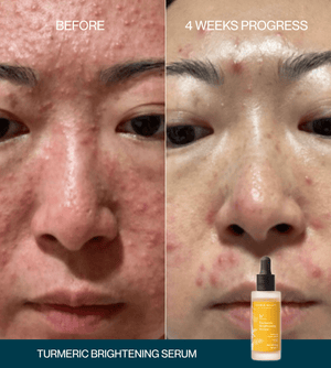 Turmeric Brightening Booster Serum