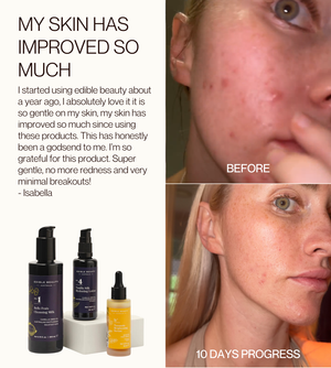 Clear & Balanced Skin Set