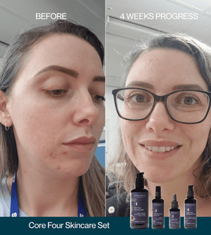 Exotic Goddess Ageless Serum Discovery Set