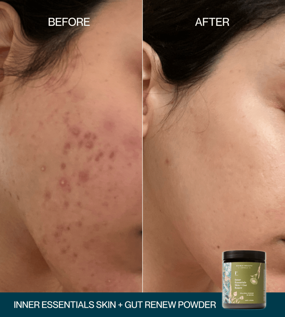 Skin + Gut Renew Duo