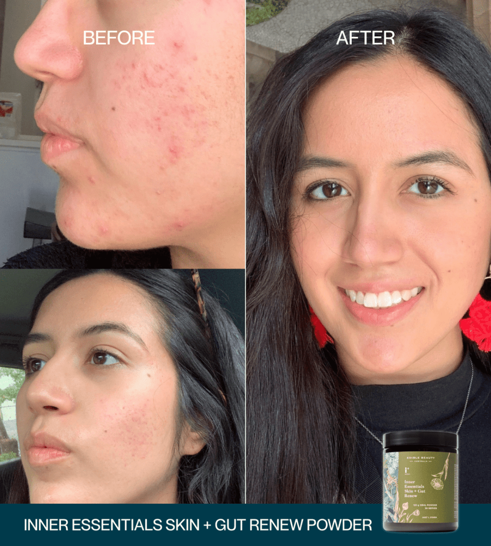 Skin + Gut Renew Duo
