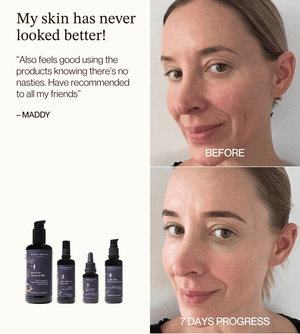 Natural Retinol Alternative Discovery Set