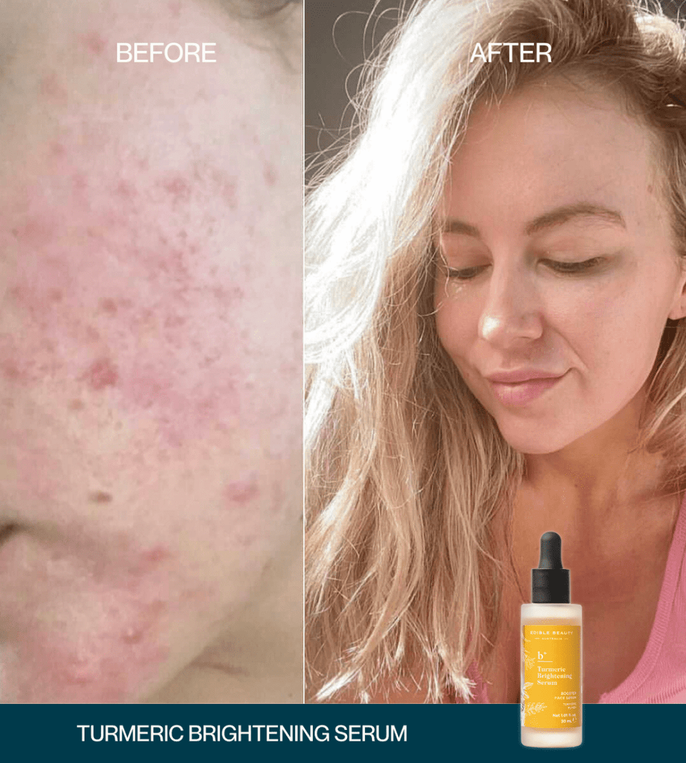 Turmeric Brightening Booster Serum
