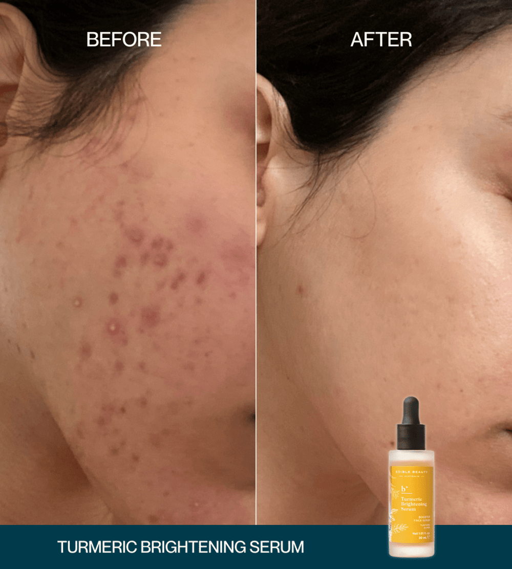 Turmeric Brightening Booster Serum